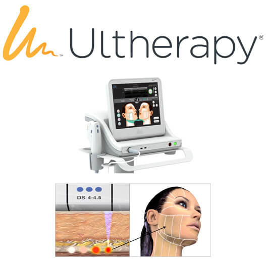 Ultherapy photo