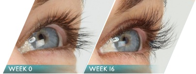 Blog - EYELASH LENGTHENING WITH LATISSE Photo 