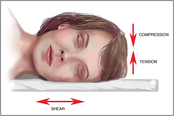 Blog - SLEEPING POSITIONS MAY CAUSE WRINKLES OVER TIME Photo 