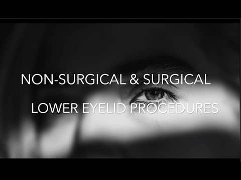 Watch Video: Undereye Bag & Dark Circle Treatment Options in NYC | Dr. Forley