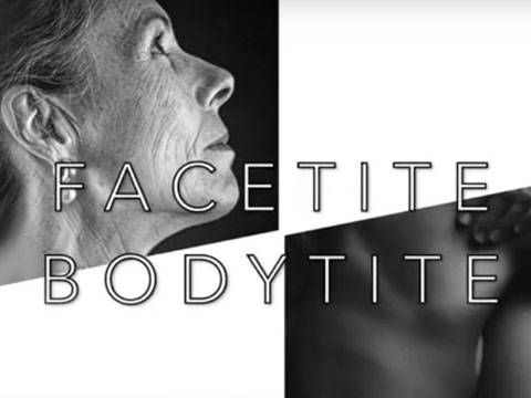Watch Video: Facetite Bodytite