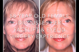 Watch Video: 58 year old female Discusses Her Facelift and Eyelid Surgery experience