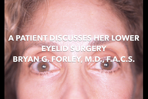 Watch Video: A patient discusses her lower eyelid surgery, Bryan G. Forley