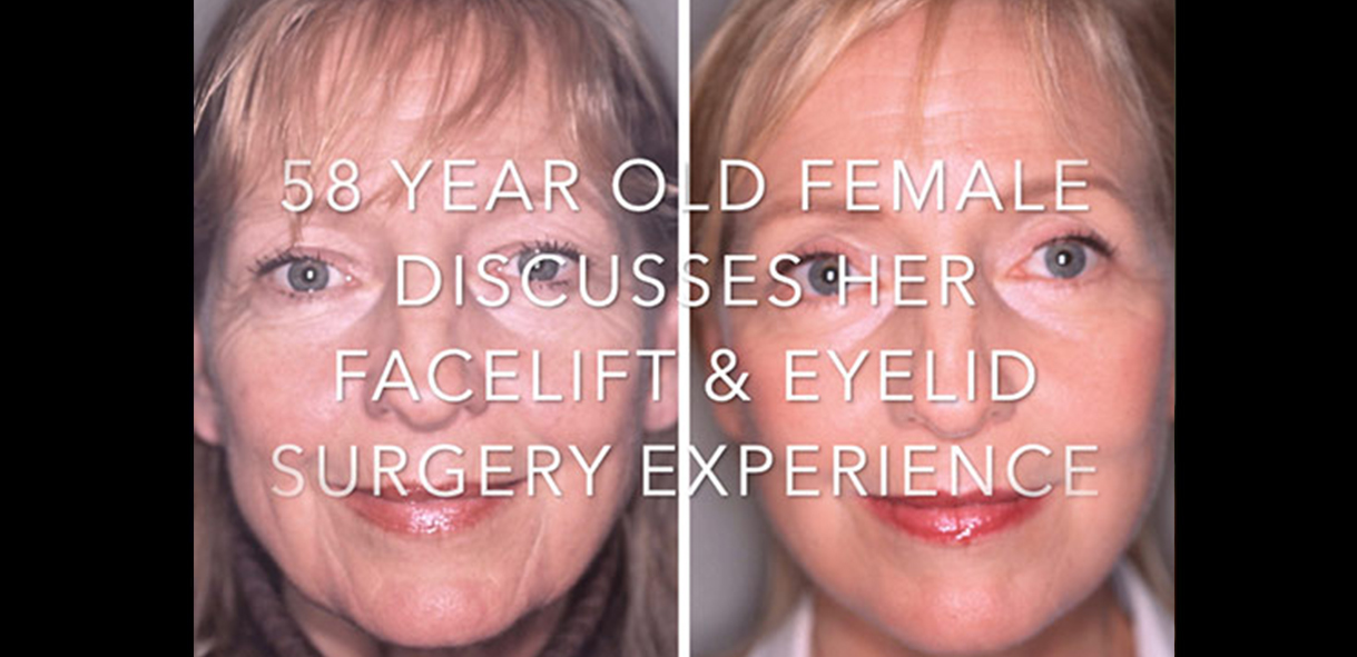 Watch Video: A Patient Discusses Her Facelift and Eyelid Surgery | Dr. Forley